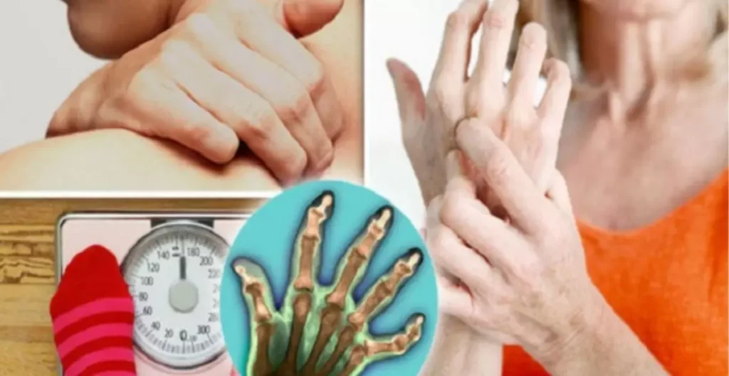 Symptoms of Rheumatoid Arthritis