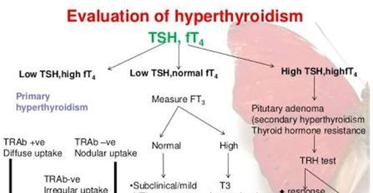 Hyperthyroidism, symptoms, causes, and treatment