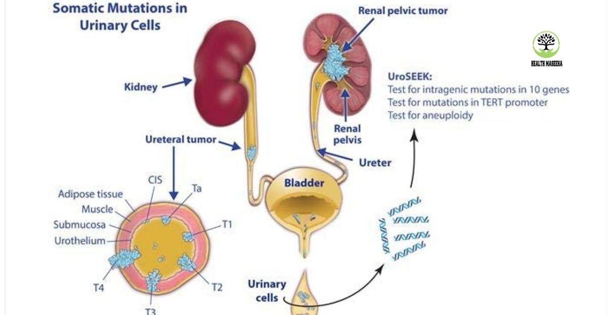 What is a UTI? Urinary Tract Infection Complete Guide