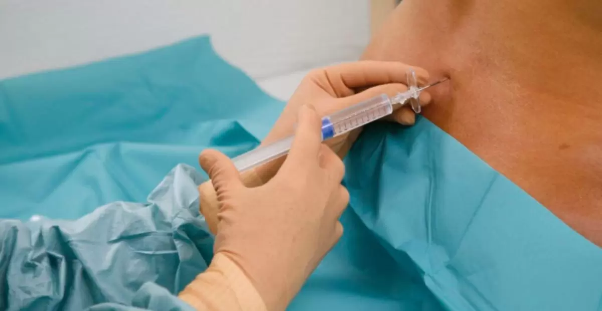 Epidural Steroid Injections: Benefits and Considerations