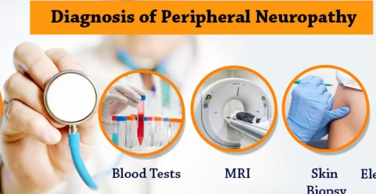 Diagnosing Neuropathy