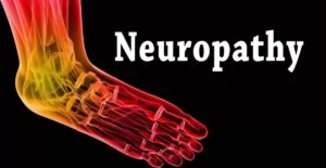 What Triggers Neuropathy In Feet?