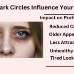 How Dark Circles Influence Your Look?