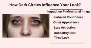 How Dark Circles Influence Your Look?